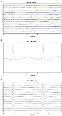 A Novel Method Based on Combination of Independent Component Analysis and Ensemble Empirical Mode Decomposition for Removing Electrooculogram Artifacts From Multichannel Electroencephalogram Signals